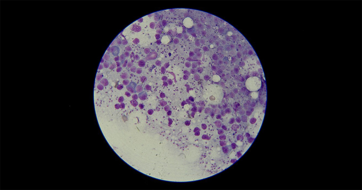 leishmania