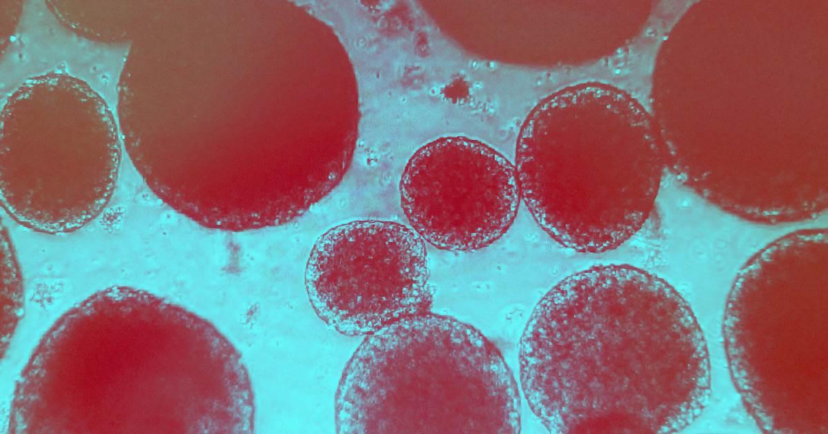 SITE 313 Epilepsia 0 1200