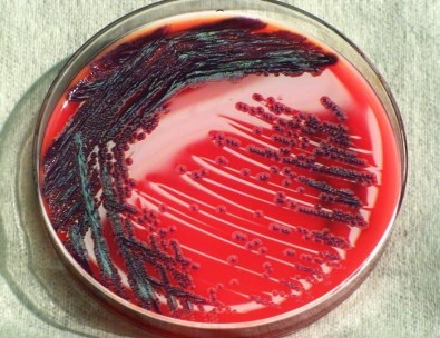 bacteriaoportonista
