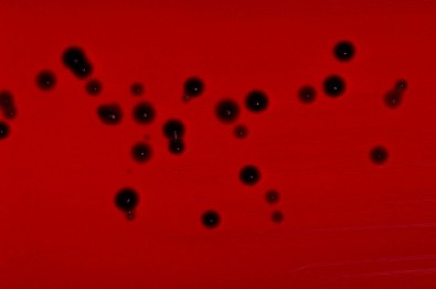 bacterias