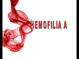 hemofilia