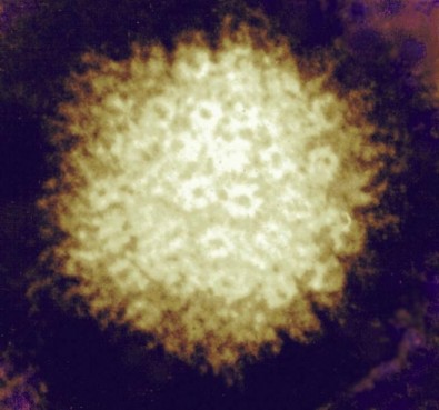 herpes
