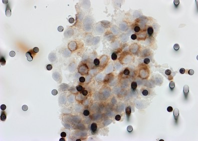 microemboem