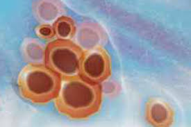 oncologico