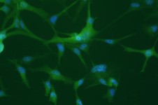 rna
