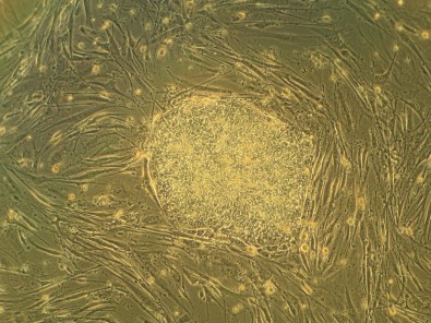 terapiacelular