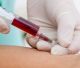 FDA aprova novo exame de sangue para rastreamento do câncer colorretal