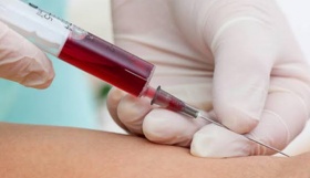 FDA aprova novo exame de sangue para rastreamento do câncer colorretal