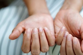 Anvisa determina recolhimento de cosméticos com alegações terapêuticas