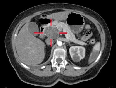 cancerproteina