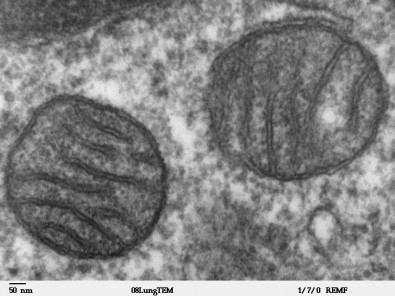 celula1