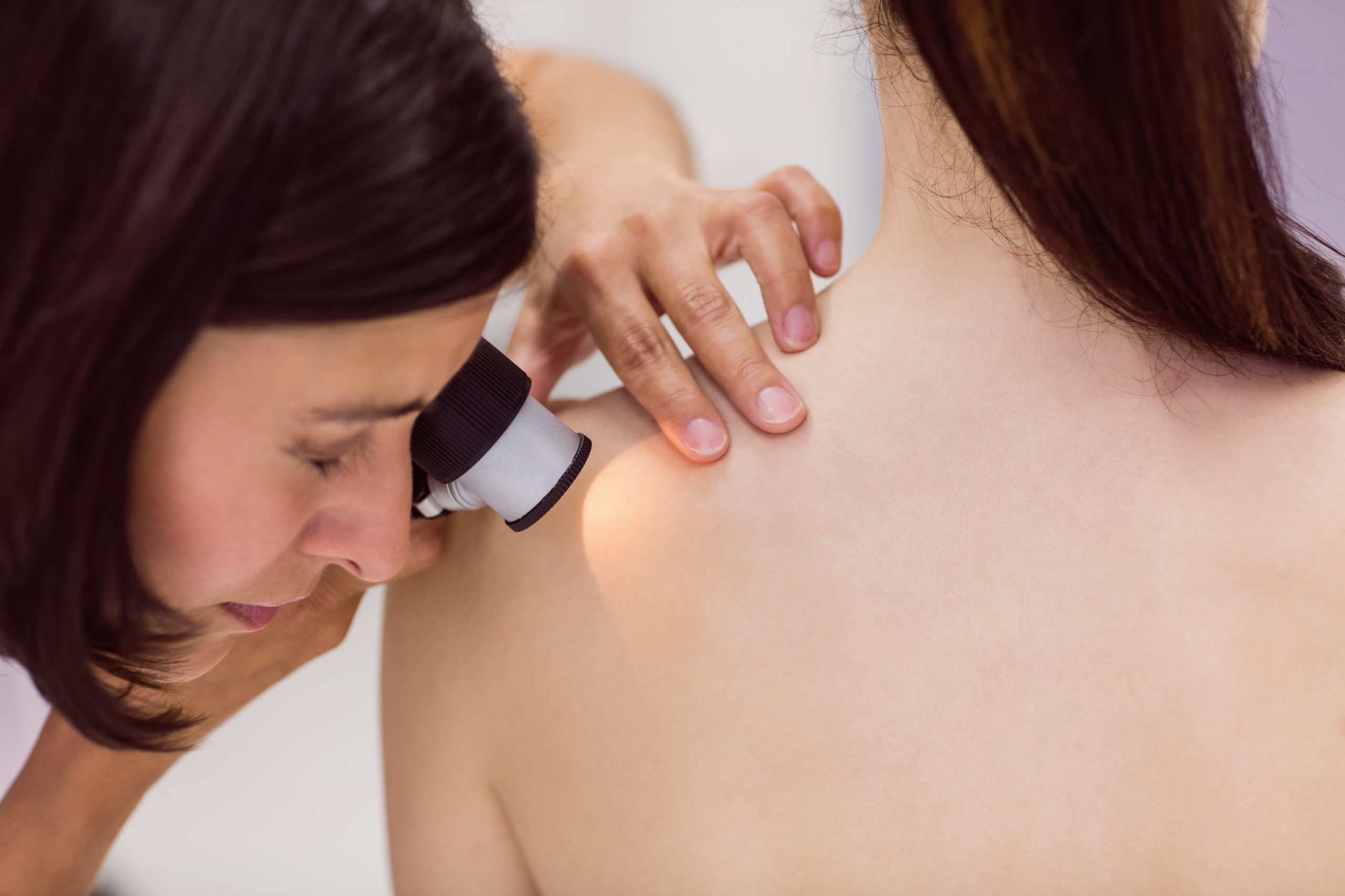 dermatologist examining skin of patient with dermatoscope 1 scaled
