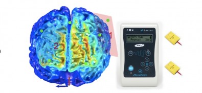 estimulacaocraniana