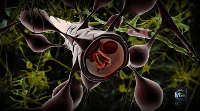 hematoencef