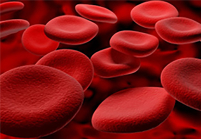 hemocromatose