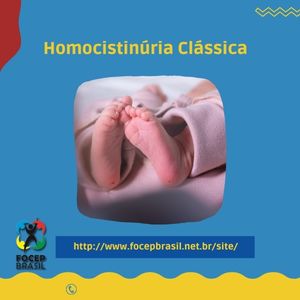 homocistinuria
