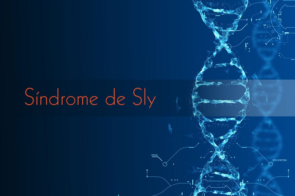 sindromesly