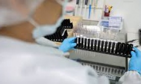 Fiocruz obtém patente para tratamento contra malária resistente